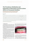 Research paper thumbnail of The Prevalence, Distribution and Expression of Noncarious Cervical Lesions (NCCL) in Permanent Dentition