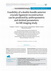 Research paper thumbnail of Feasibility of a double-bundle anterior cruciate ligament reconstruction can be predicted by anthropometric and skeletal parameters: An MR imaging study