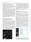 Research paper thumbnail of P843Left ventricular twist for the diagnosis of left ventricular non-compaction in children and young adults