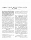 Research paper thumbnail of Malignant Perivascular Epithelioid Cell Tumour ("PEComa") of Soft Tissue