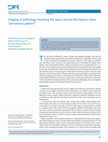 Research paper thumbnail of Imaging of pathology involving the space around the hepatic veins: "perivenous pattern