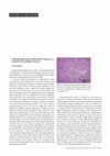 Research paper thumbnail of Methylprednisolone induced liver injury in a patient with multiple sclerosis