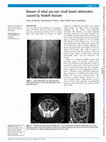 Research paper thumbnail of Beware of what you eat: small bowel obstruction caused by freekeh bezoars