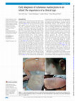 Research paper thumbnail of Early diagnosis of cutaneous mastocytosis in an infant: the importance of a clinical sign