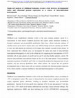 Research paper thumbnail of Single-cell analysis of childhood leukemia reveals a link between developmental states and ribosomal protein expression as a source of intra-individual heterogeneity