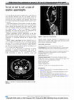 Research paper thumbnail of To cut or not to cut: a case of epiploic appendagitis