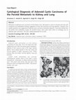 Research paper thumbnail of Cytological diagnosis of adenoid cystic carcinoma of the parotid metastatic to kidney and lung