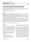 Research paper thumbnail of Contrast-free high-resolution 3D magnetization transfer imaging for simultaneous myocardial scar and cardiac vein visualization