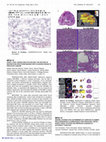 Research paper thumbnail of MP02-14 Voxel Level Radiologic-Pathologic Validation of Restriction Spectrum Imaging with Gleason Grade in Prostate Cancer