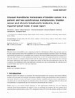 Research paper thumbnail of Unusual mandibular metastasis of bladder cancer in a patient and two synchronous malignancies, bladder cancer and chronic lymphocytic leukemia, in an inguinal lymph node: A case report