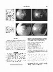 Research paper thumbnail of Retinal Vasculitis with a Frosted Branch Angiitis???Like Response Due to Herpes Simplex Virus Type 2