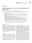 Research paper thumbnail of Blunt cervical spine trauma as a cause of spinal cord injury and delayed cortical blindness