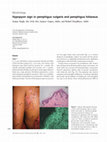 Research paper thumbnail of Hypopyon sign in pemphigus vulgaris and pemphigus foliaceus