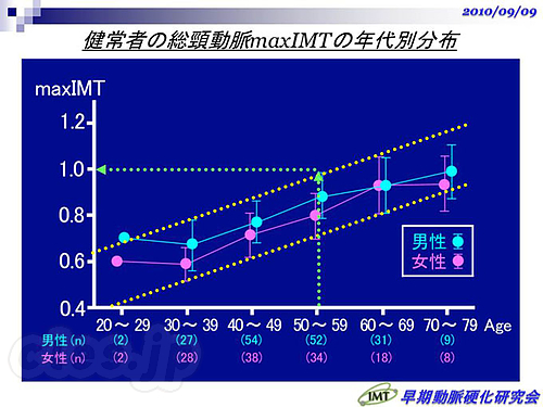 健常者の総頸動脈maxIMTの年代別分布 - 頸動脈エコーを受けてきた