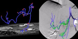 Registration of Angiographic Images