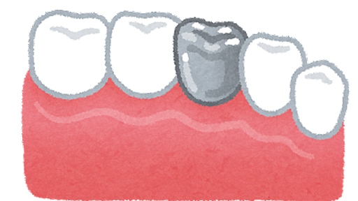 【驚愕】銀歯を『全部』セラミックに変えた結果が凄すぎるｗｗｗ