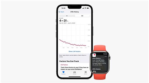 Apple Watchの心房細動履歴機能、日本で承認取得！watchOS11で解禁？ - iPhone Mania