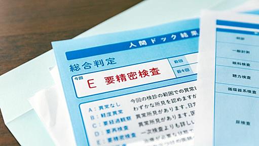 人間ドック､医師が教える｢ほぼ無意味な検査｣2つ