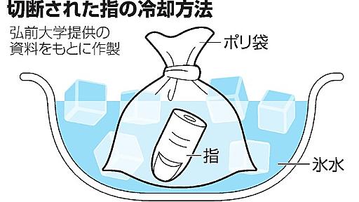 指の切断　正しい冷却なら８時間まで再接着可能：朝日新聞デジタル