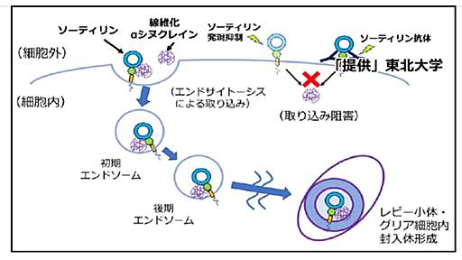 パーキンソン病発症の仕組み解明と東北大が発表　ソーティリンというタンパク質がαシヌクレインを細胞内に取り込み蓄積　進行抑制治療薬開発にも期待 | TBS NEWS DIG