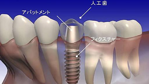 WEB業界の黒歴史　ヤラセ投稿 - はてな村定点観測所