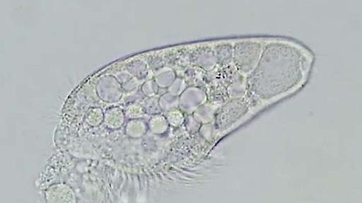 「素晴らしい」「涙が出る」　単細胞生物が寿命を迎える瞬間に、感動の声