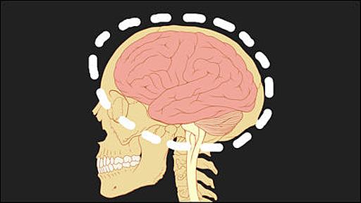 人間の記憶を保存できるデバイスを脳に移植して失われた記憶力を補完する研究が進行中