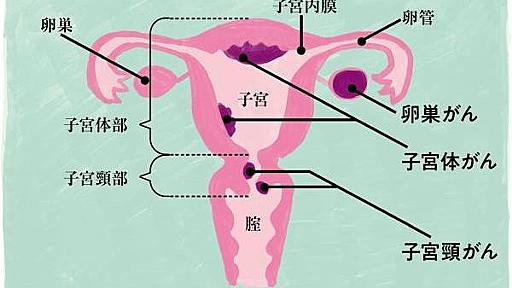 閉経後に高まる「子宮体がん」リスクにどう対処する？