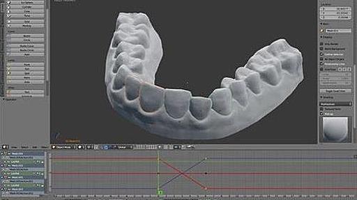 アメリカの大学生、3Dプリンターを使って自分の歯の矯正に成功「90万円→7000円になった」 : らばQ