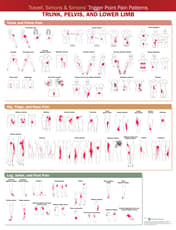 Travell, Simons & Simonsâ Trigger Point Pain Patterns Wall Chart