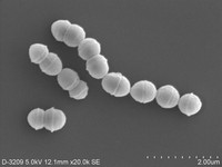 Group A hemolytic streptococcus bacteria, the main cause of streptococcal toxic shock syndrome, are seen in this image provided by the National Institute of Infectious Diseases.