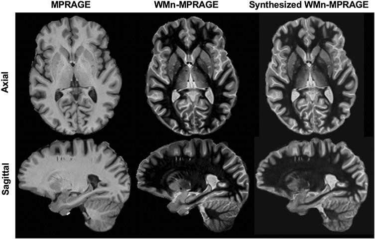 Fig. 3: