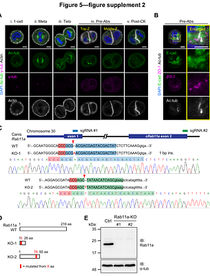 Centrosome Migration and Apical Membrane Formation in Polarized Epithelial Cells: Insights from the MDCK Cyst Model