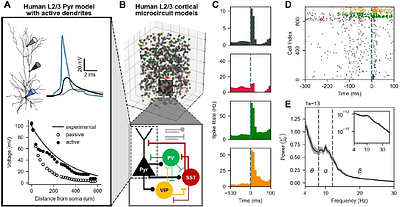Spine loss in depression impairs dendritic signal integration in human cortical microcircuit models