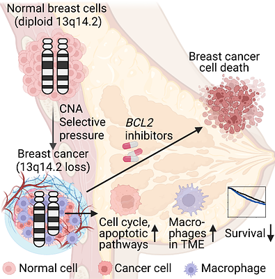 Loss of chromosome cytoband 13q14.2 orchestrates breast cancer pathogenesis and drug response
