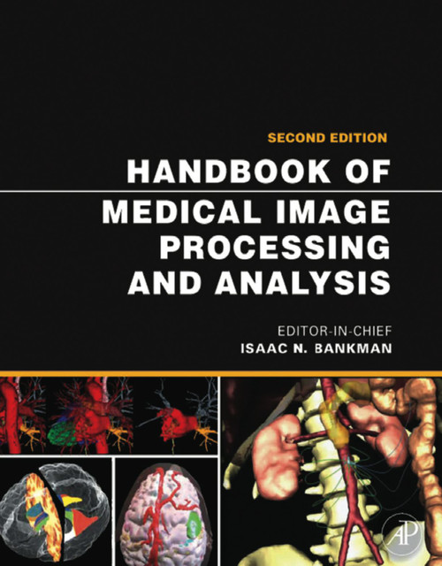 (eBook PDF) Handbook of Medical Image Processing and Analysis  2nd Edition