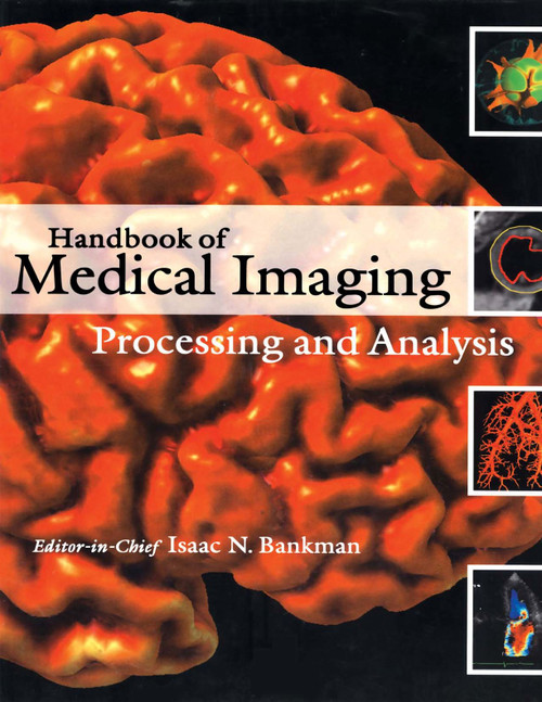 (eBook PDF) Handbook of Medical Imaging: Processing and Analysis Management