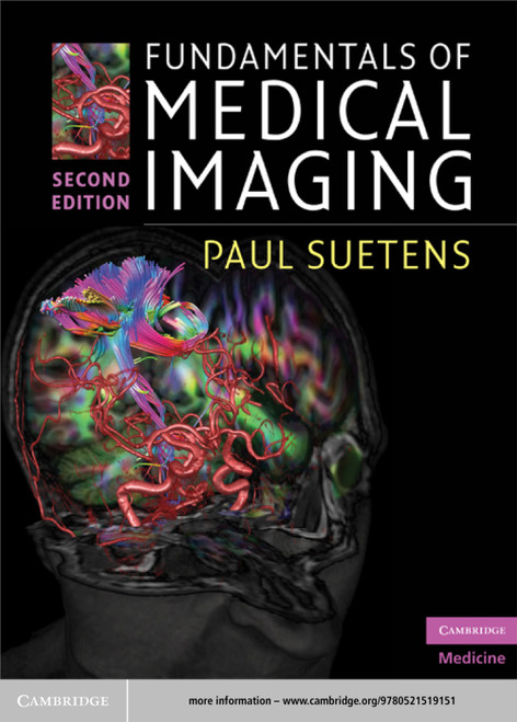 (eBook PDF) Fundamentals of Medical Imaging  2nd Edition