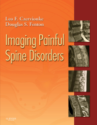 Cover image: Imaging Painful Spine Disorders - Electronic 1st edition 9781416029045