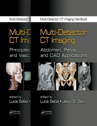 Cover image: Multi-Detector CT Imaging Handbook, Two Volume Set 1st edition 9781439893999