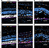 IHC confirms damage to photoreceptors and RPE and shows immune cell activat