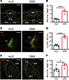 Profiling of c-Fos expression with multiple brain regions after the EPM tes