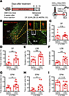 Chemogenetic inhibition of LC-NE projections to the BLA reduces anxiety-lik