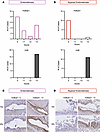 H2Bub1 loss is detected in CCOC precursors.