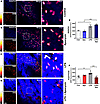 Apocynin reduces superoxide in cardiac tissue (left ventricle).