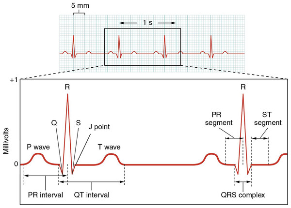 Schematic example of an electrocardiogram (ECG).