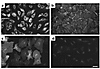 Characterization of hemangioma-derived endothelial cells by indirect immuno