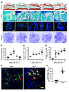 CGRP+ sensory nerves in subchondral bone increased along with an increase i