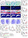 Decreased sprouting of CGRP+ sensory nerves in the subchondral bone and pai