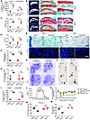 Knockout of Netrin1 in osteoclast-lineage cells reduces sprouting of CGRP+